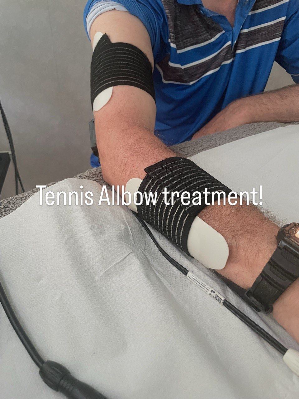 Winback tecar therapy treatment for tennis elbow